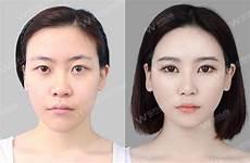 10大最成功整容案例