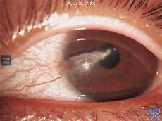 隔山有眼1未分级版